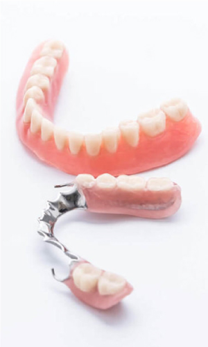 Prótese dentária parcial